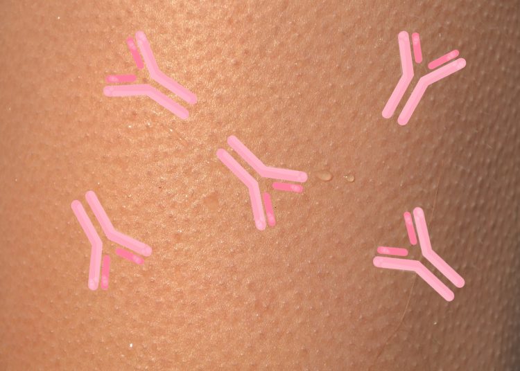 skin immune system