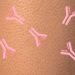 skin immune system