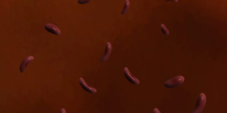 Sickle cells in blood stream